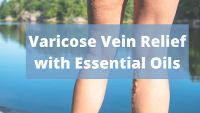 Varicose Vein Relief with Essential Oils